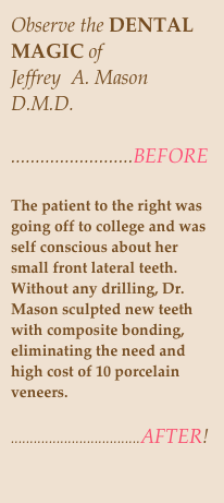 Observe the DENTAL MAGIC of 
Jeffrey  A. Mason D.M.D.
                                                    .........................BEFORE

The patient to the right was going off to college and was self conscious about her small front lateral teeth.   Without any drilling, Dr. Mason sculpted new teeth with composite bonding, eliminating the need and high cost of 10 porcelain veneers. 
    ..................................AFTER!                                         

 
                                                   





Watch the video on the left as
 5- year- old Jericho gets novocaine for the first time from Dr. Mason.


                                                 AFTER  